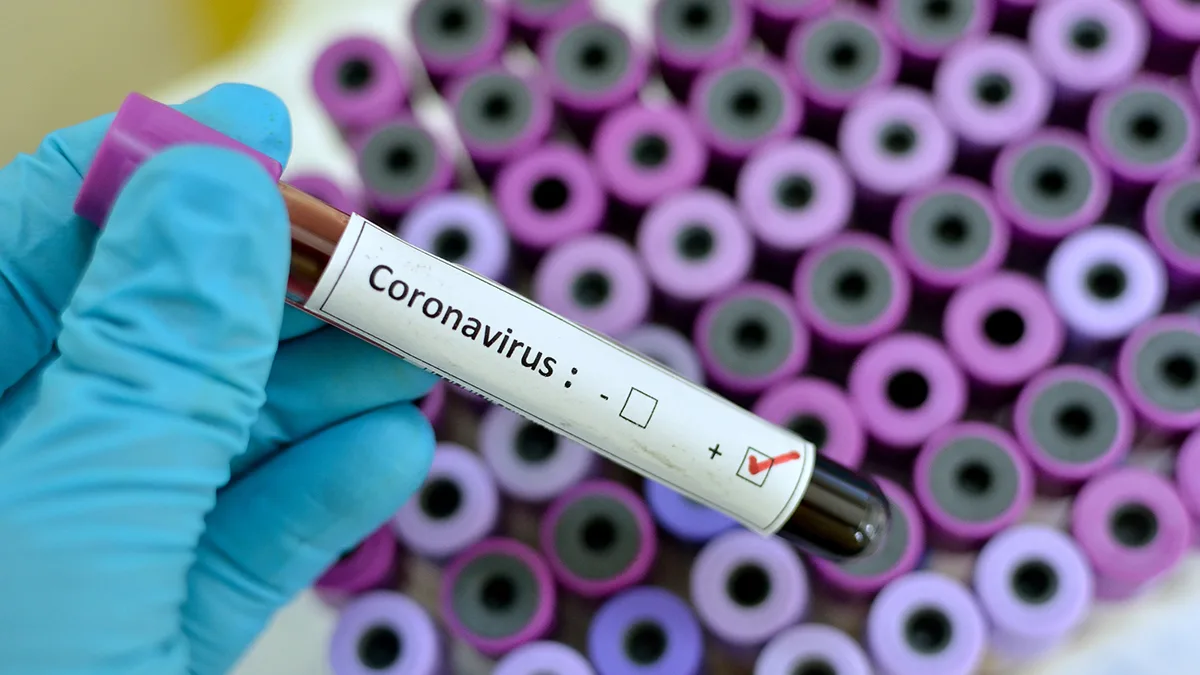 Coronavirus Test Labor Foto iStock Jarun011 Coronavirus Test Labor Foto iStock Jarun011.jpg