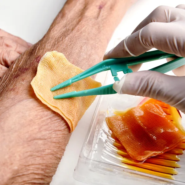 Wundversorgung Arm iStock Artfully79.jpg